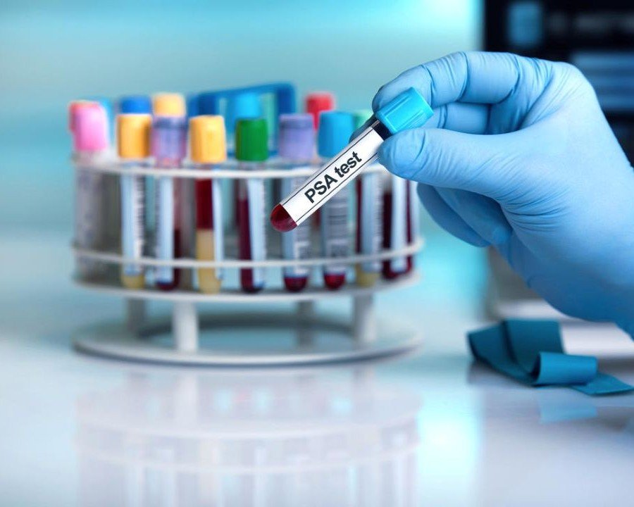 Giornata mondiale per la lotta contro il cancro: in Trentino 3.470 nuovi casi l’anno